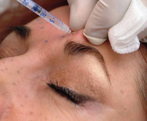 Confession: I Had Botox For My Migraines