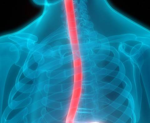 All you need to know about Barrett’s Oesophagus
