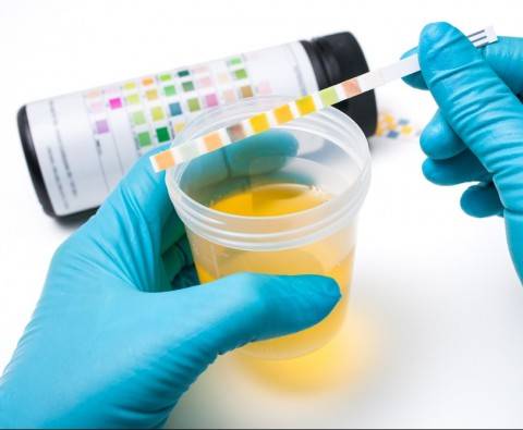 What can a urine test reveal about your body?