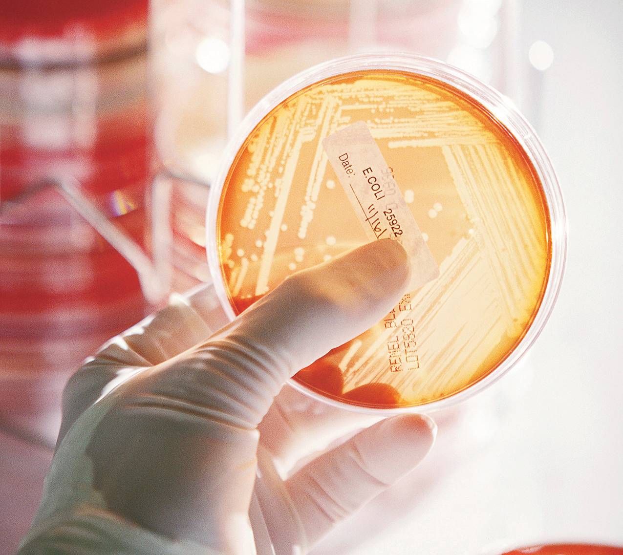 A culture of the potentially deadly Escherichia coli
